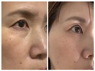 女性専用エステルーム Rerelaリレラのエステ・リラクイメージ