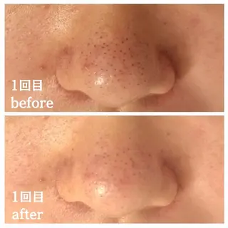 フェイシャル専門サロ ン　ERINのエステ・リラクイメージ