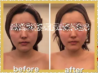 Le lien ルリアンのエステ・リラクイメージ