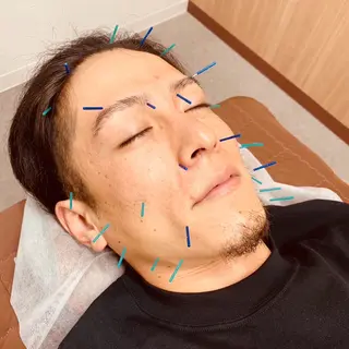 NO.10 整骨院のエステ・リラクイメージ