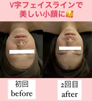 骨から若返る美骨＆ 小顔サロンクラルテのエステ・リラクイメージ