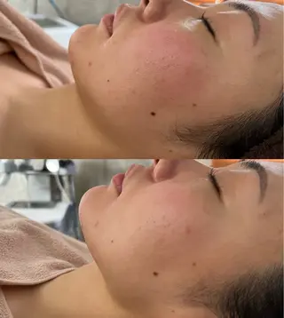 MEREA  personal esthe所属・感動的オーダーメイド エステMEREAのエステ・リラクイメージ