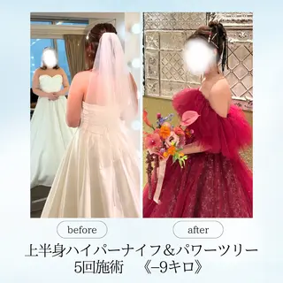 espresso,所属・《痩身、小顔専門店》 エスプレッソのエステ・リラクイメージ