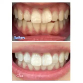 Ｍ渋谷 ホワイトニングのエステ・リラクイメージ