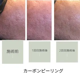 salon mijoaのエステ・リラクイメージ