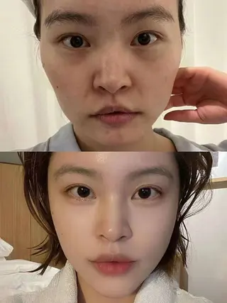 マツエク・マツパ aliaハーブ水光店 エステティシャン募集のエステ・リラクイメージ