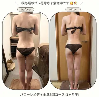 《本気痩せ×疲労改善 》  BILOOPのエステ・リラクイメージ