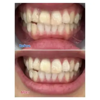 M渋谷 ホワイトニングのエステ・リラクイメージ