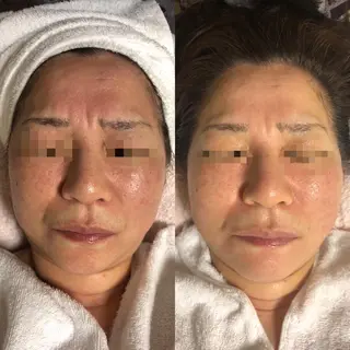 エスカル ボーテのエステ・リラクイメージ