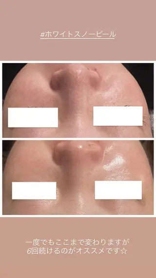 Raviy 【痩身・韓国肌管理】のエステ・リラクイメージ