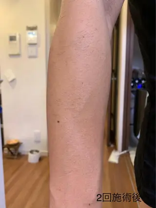 脱毛サロン Plageプラージュのエステ・リラクイメージ