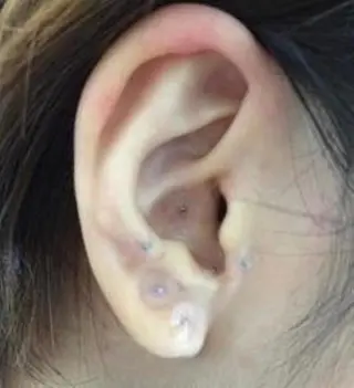 MOXA鍼灸院所属・MOXA鍼灸院 旧:鍼灸整体院Ranのエステ・リラクイメージ