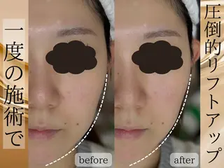 Rairy Salon富士見町のエステ・リラクイメージ