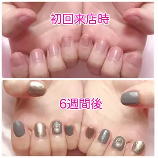 ネイル 深爪を断らない スカルプ高評価店のネイルデザイン