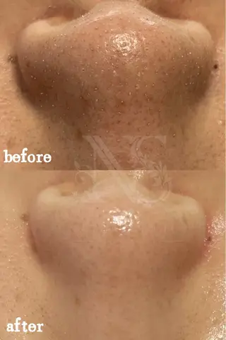 Nature Souce毛穴専門店のその他イメージ