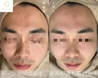 ハーブピーリング専門 サロンドレナ　白藤のエステ・リラクイメージ