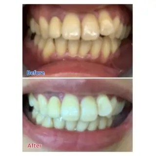 Ｍ渋谷 ホワイトニングのエステ・リラクイメージ