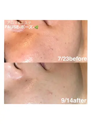 浜野 恵美のエステ・リラクイメージ