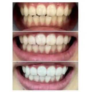 M渋谷 ホワイトニングのエステ・リラクイメージ