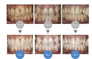 Ｍ渋谷 ホワイトニングのエステ・リラクイメージ