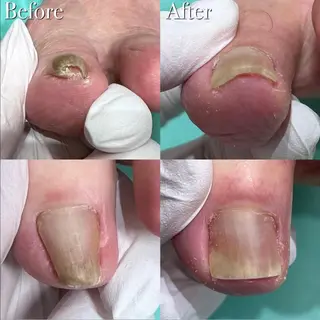 巻き爪アカデミー 溝の口のネイルデザイン