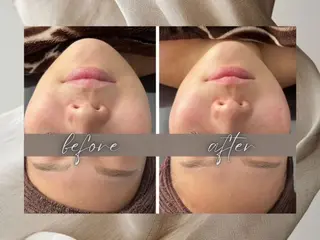 小顔・毛穴/ニキビ/ ハーブピーリング専門のエステ・リラクイメージ