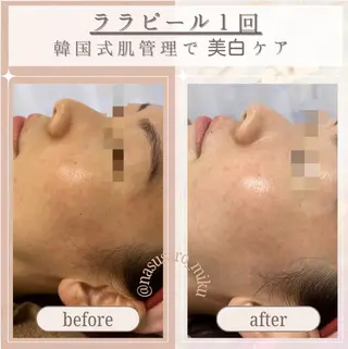 🎀韓国式肌改善🎀 Miku🇰🇷💎のエステ・リラクイメージ