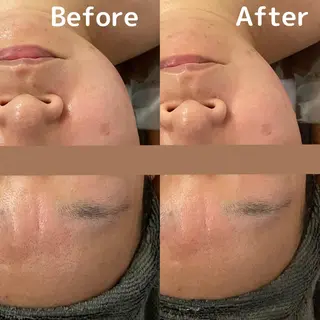 DUPE&MORE 店長kanaeのエステ・リラクイメージ