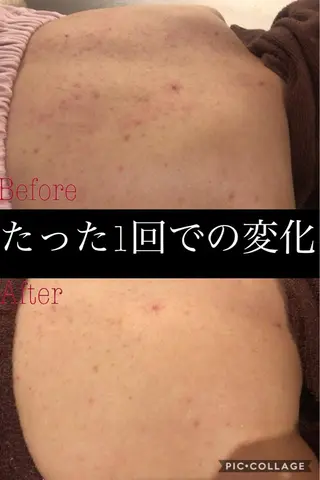 ミディアム カラー パーマ ヘアアレンジ メンズ キッズ ネイル マツエク・マツパ ニキビ・肌質改善専門 ♡人生が変わるサロンのエステ・リラクイメージ