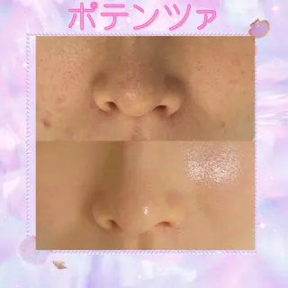 マツエク・マツパ 愛維美水光美肌専門店 メンズレディースokのエステ・リラクイメージ