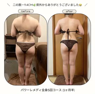 《本気痩せ×疲労改善 》  BILOOPのエステ・リラクイメージ