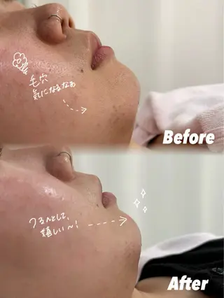 🫧美しい素肌へ🫧 今成柚乃のその他イメージ