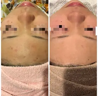 Dione 立川店のエステ・リラクイメージ