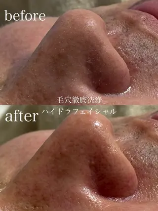 フェイシャルサロン CHIARA鈴木のエステ・リラクイメージ