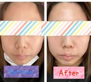 いとう なおみのエステ・リラクイメージ