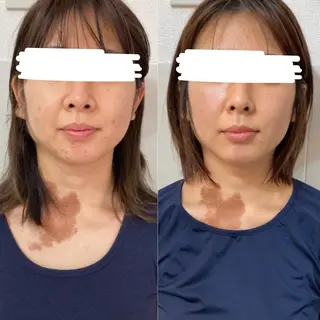 骨格美容整体 bimote.新宿のエステ・リラクイメージ