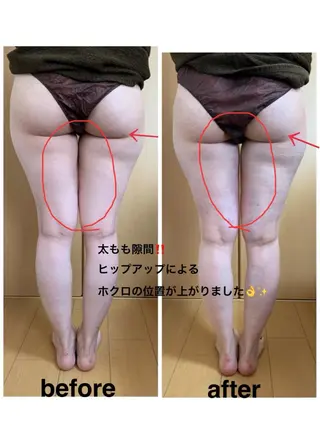 痩身/脱毛/ネイル HARUKAのエステ・リラクイメージ