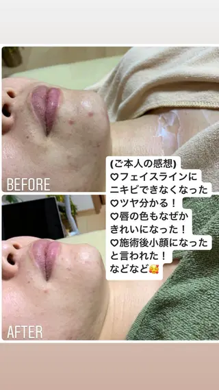 グランデ ルシアルのエステ・リラクイメージ