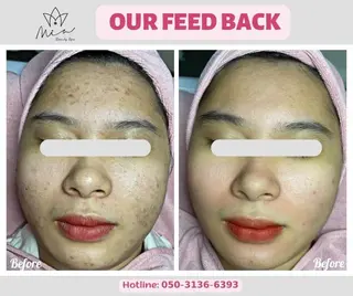 MiA Beautyのエステ・リラクイメージ