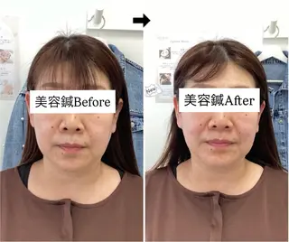 美容鍼灸×小顔整体♡ ハリサロンドオフ堺東のその他イメージ