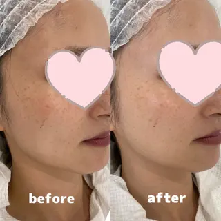 Whitening Beauty 行橋店のその他イメージ