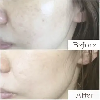 フェイシャル/毛穴 /シミ/たるみ東灘区のエステ・リラクイメージ