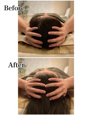 ielu〜毛穴ケア ハーブピーリングのエステ・リラクイメージ