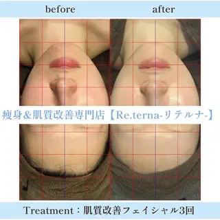 田辺🌿毛穴ケア サロンリテルナのエステ・リラクイメージ