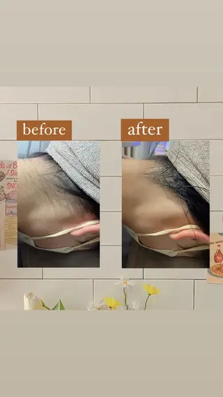 【韓国肌管理・脱毛】 クレセントのその他イメージ