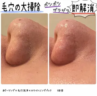 &. BYのエステ・リラクイメージ