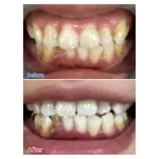 Ｍ渋谷 ホワイトニングのエステ・リラクイメージ