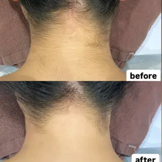 Dahlia痩身脱毛 フェイシャル 中村のエステ・リラクイメージ