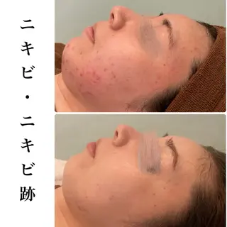 ハーブピーリング専門 BIOPLUS+川崎のエステ・リラクイメージ