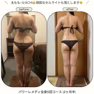 《本気痩せ×疲労改善 》  BILOOPのエステ・リラクイメージ